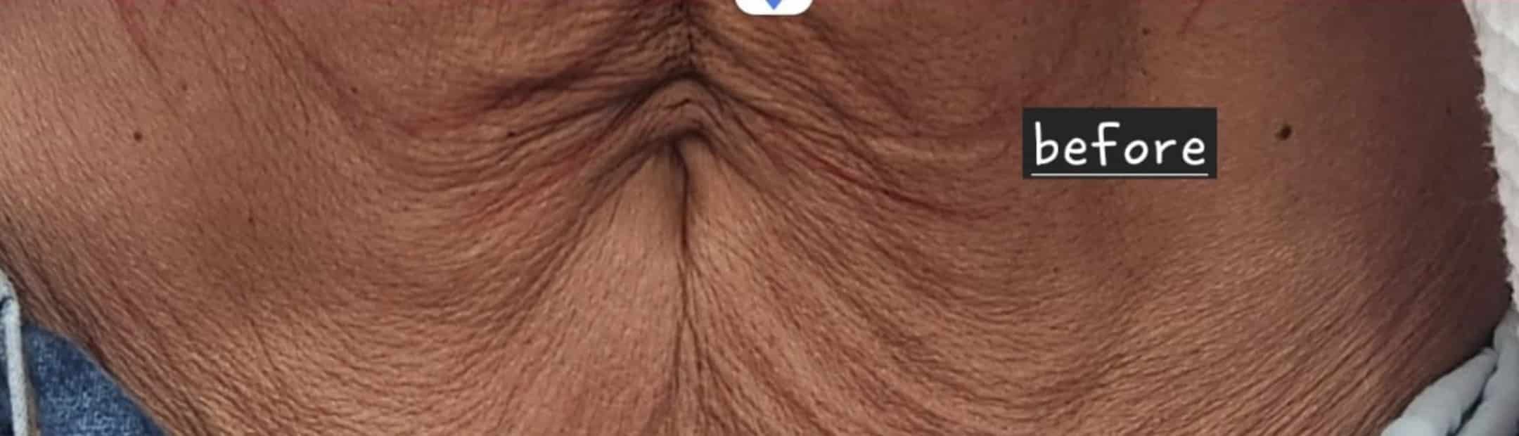 Before Image: Threads for the stomach - front