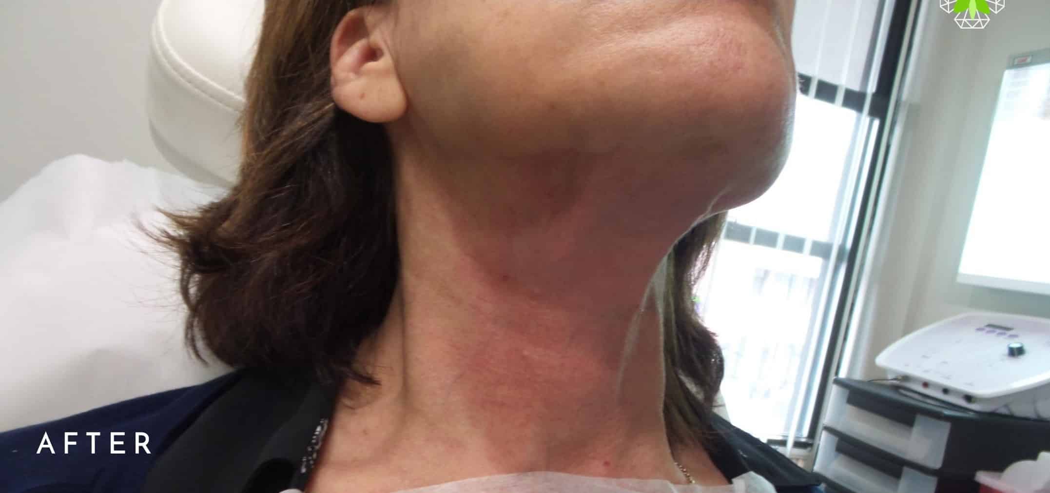 After Image: Threads Neck - front