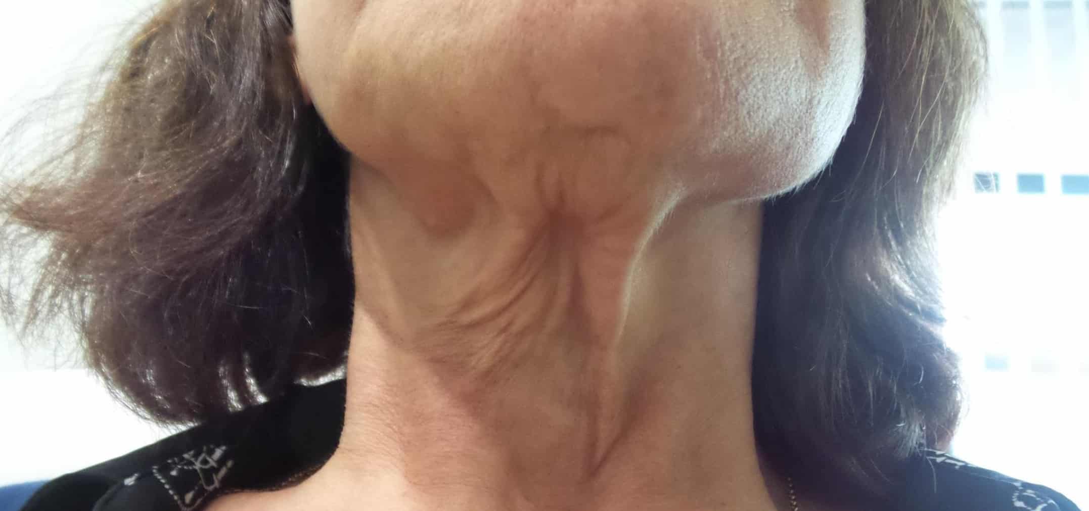 Before Image: Threads Neck - front